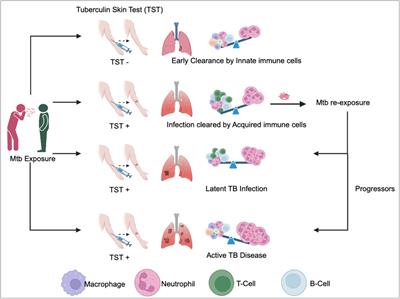 Early innate cell interactions with Mycobacterium tuberculosis in protection and pathology of tuberculosis